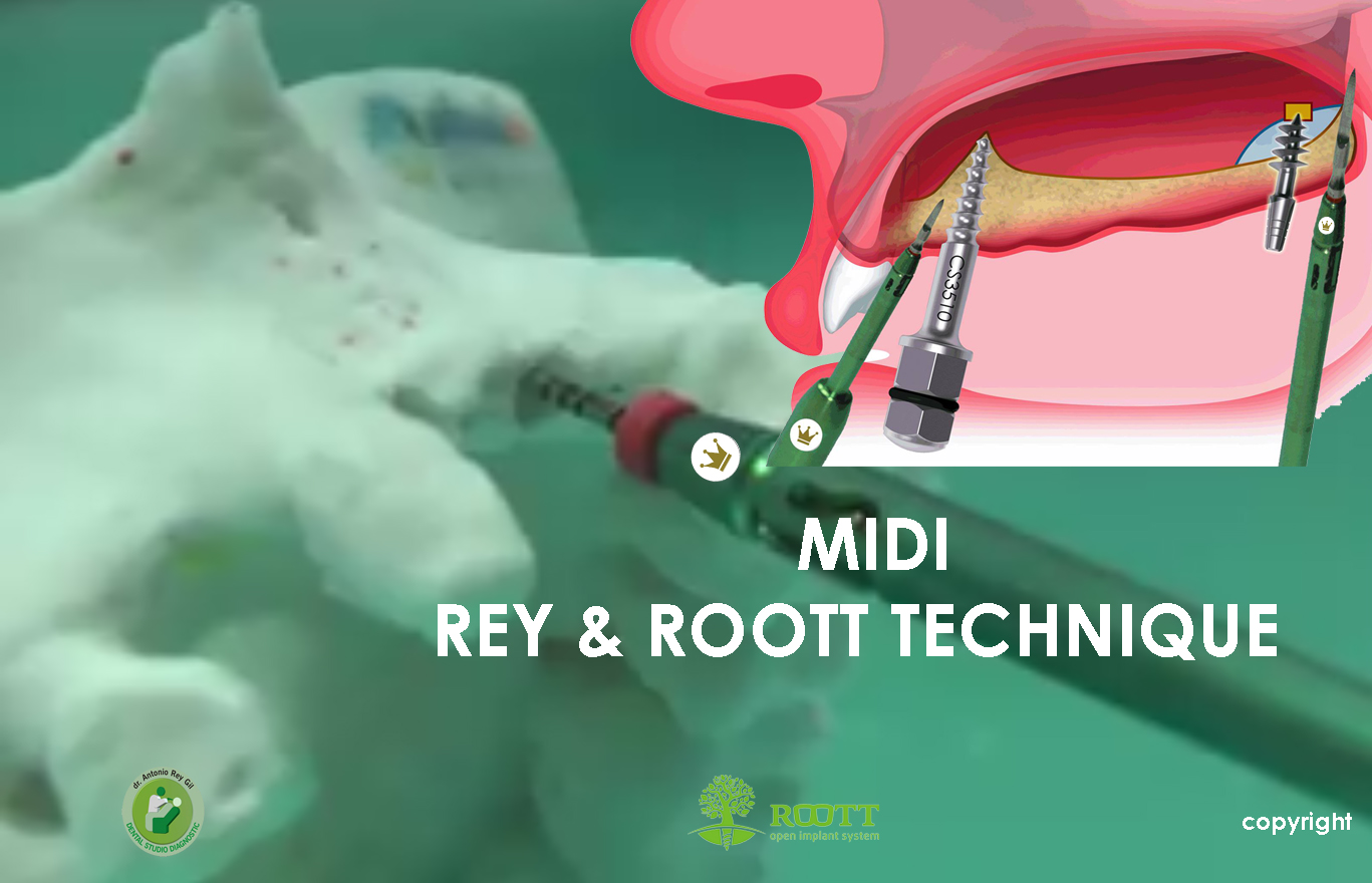 MIDI REY & ROOT