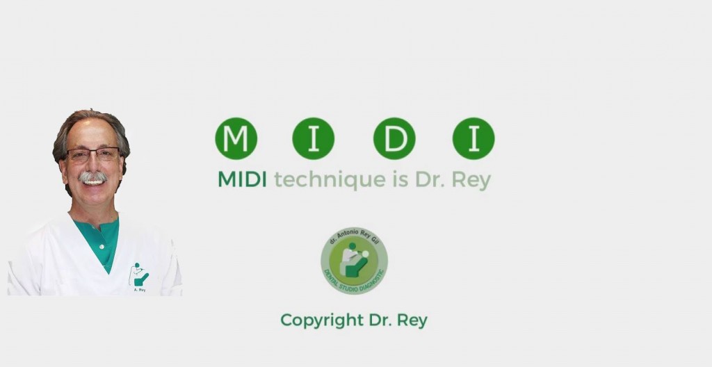 MIDI TECHNIQUE IMPLANT DR REY GIL