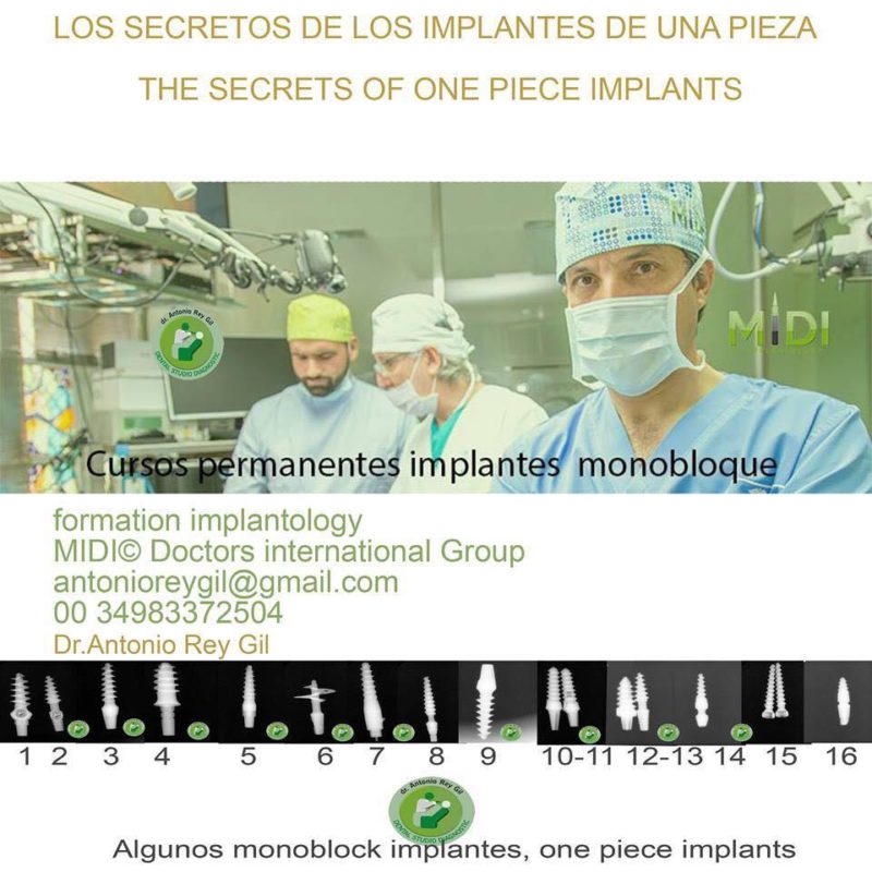 Implantes Valladolid Información