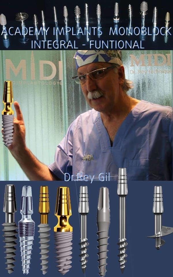 implantes información Dres Rey