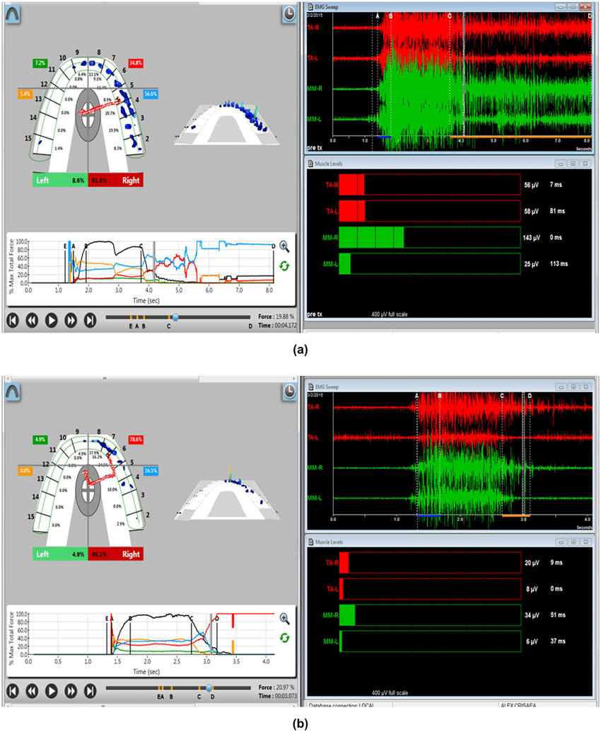 T Scan BioEMG III