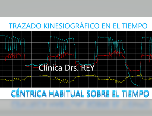 Implante Dental y Estudio Funcional