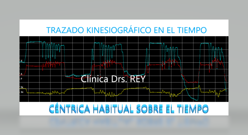 Estudio funcional