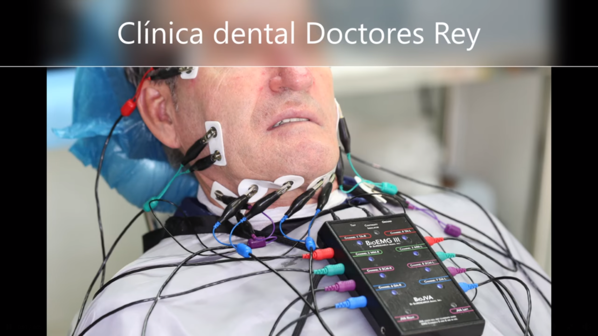 implantes dentales Dres Rey